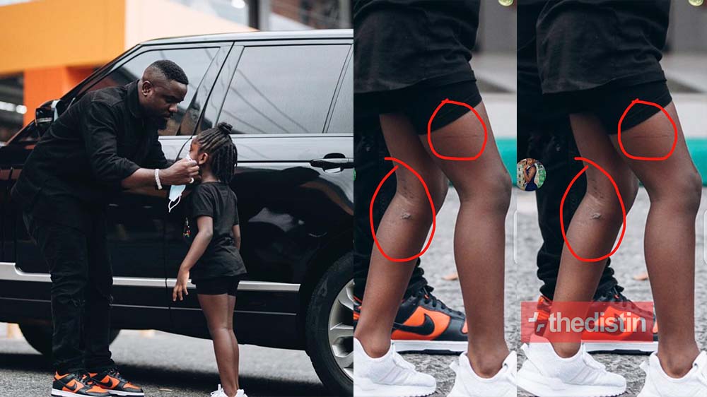 Sarkodie Accused Of Mercilessly Lashing Titi As Cane Marks And Scars Are Spotted On Her Legs, Ghanaians React (Photo)