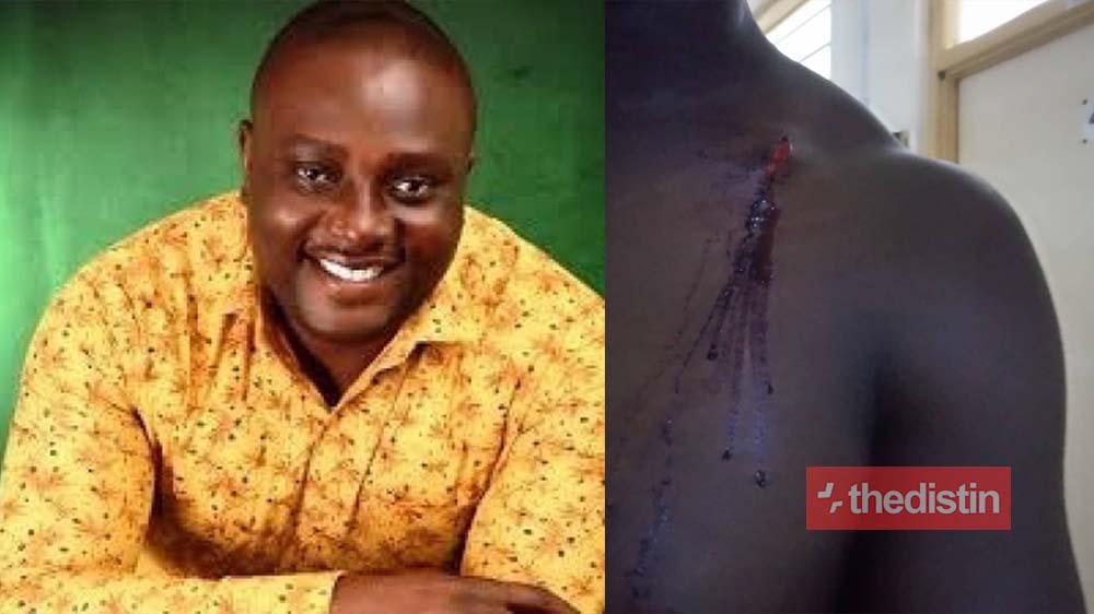 Armed Robbers Attack Fuel Station Of Keta MP Dzudzorli Kwame Gakpey, Shot Security Man And Get Away With GHC 7000 Cedis (Photos)